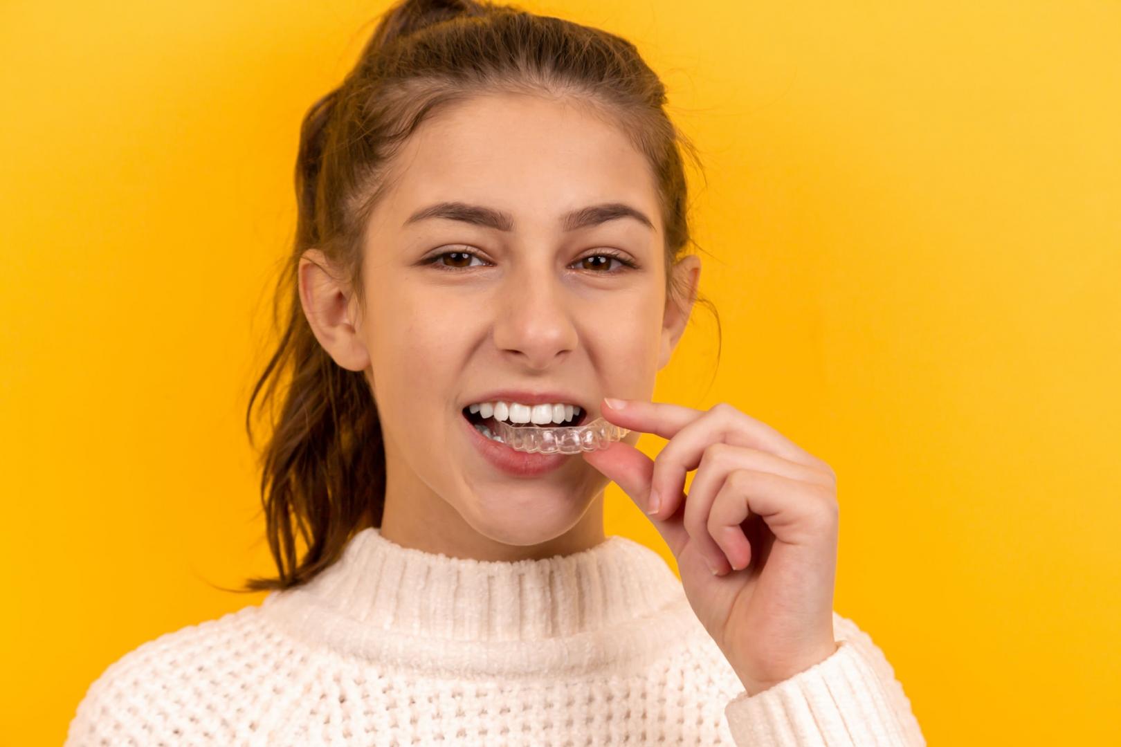  Hogyan lehet fogat fehéríteni?
