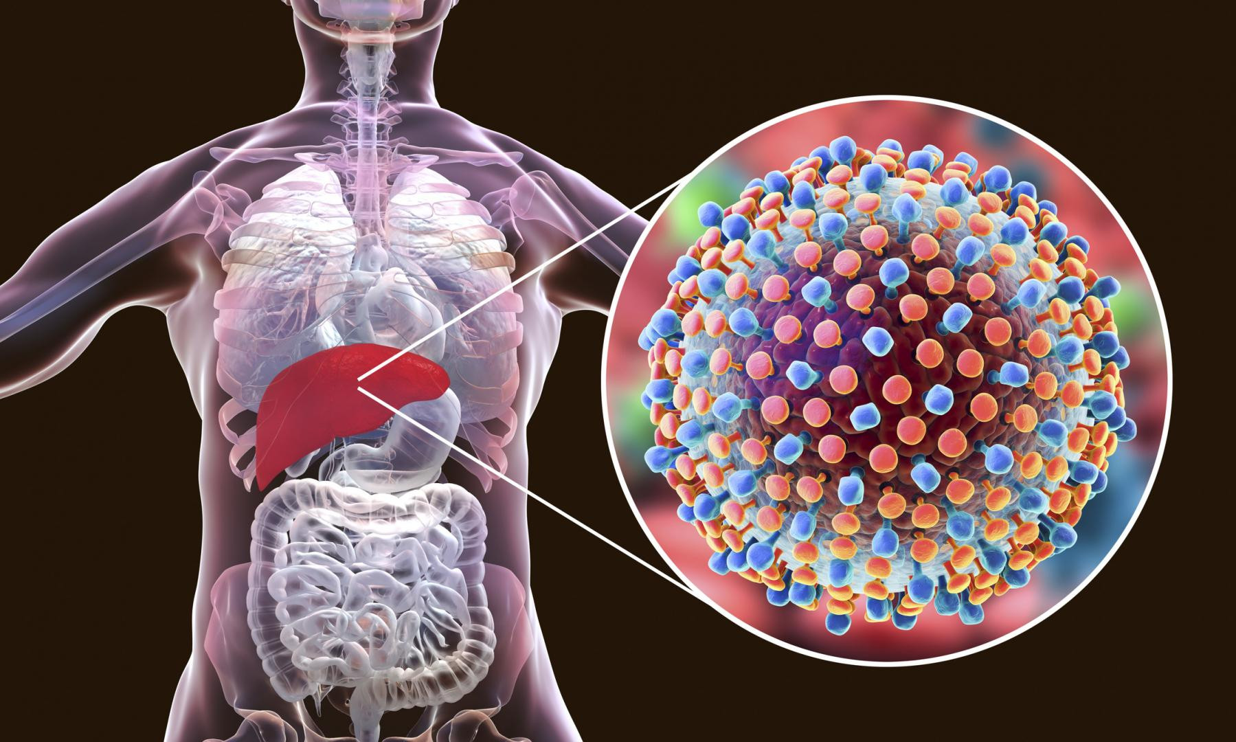 Hepatitisz-C